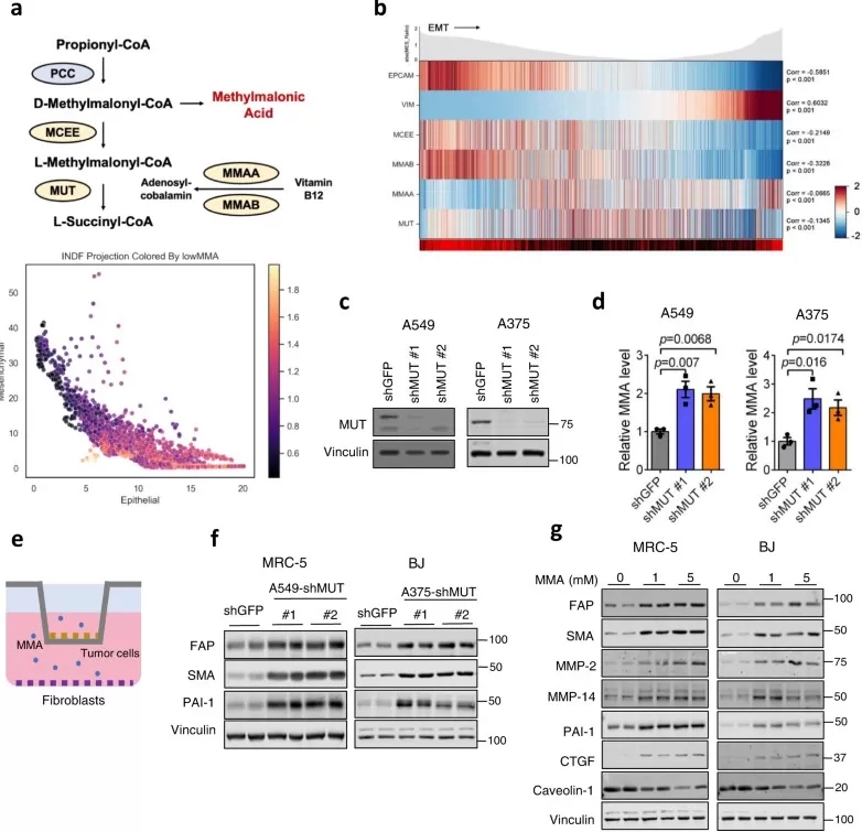 Composite panel showing the propionate→methylmalonyl-CoA→succinyl-CoA pathway (PCC, MCEE, MUT), single-cell heatmap linking low MUT/MCEE/MMAA/MMAB to mesenchymal signatures, MUT knockdown increasing MMA, and co-culture/exogenous MMA inducing CAF markers (FAP, SMA, PAI-1)—evidence that methylmalonic acid drives CAF activation and EMT.
